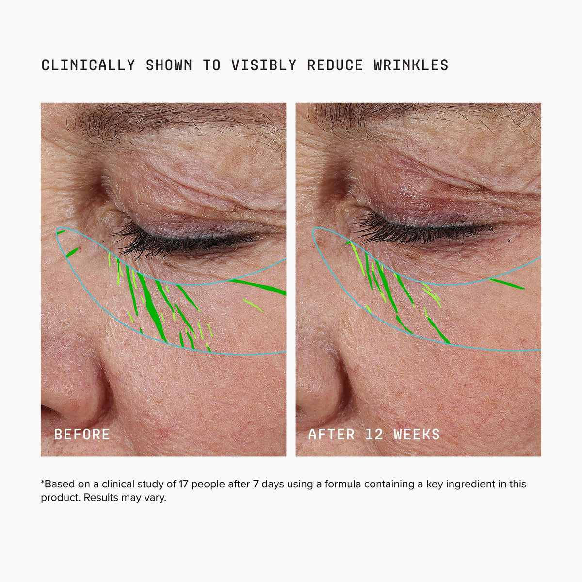Mini Needle-less® Growth Factor Serum