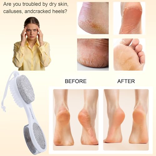 Foot Scrubber Brush with Pumice Stone for Feet Callus Remover Pedicure Tool - color: White