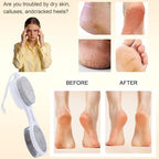 Foot Scrubber Brush with Pumice Stone for Feet Callus Remover Pedicure Tool - color: White