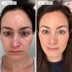 Omnilux Contour Face