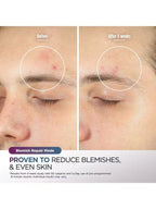 Shark CryoGlow FW312UK LED Anti-Ageing & Blemish Repair Face Mask - Lilac